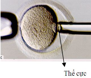Kỹ thuật sinh thiết phôi trong chẩn đoán di truyền trước làm tổ