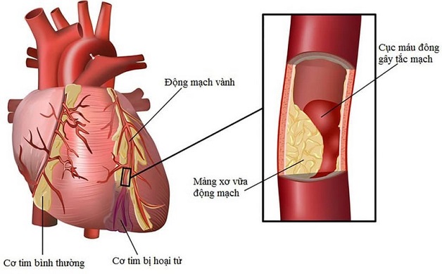 Dịch vụ khám tim và mạch máu tại Đà Nẵng